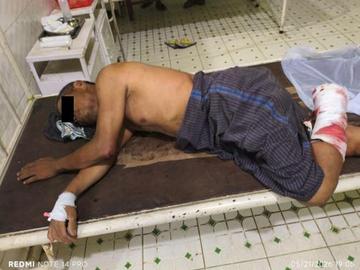 Innocent Civilian Injured in Improvised Explosive Device Explosion Planted by KIA Insurgents in Taning Township of Kachin State.