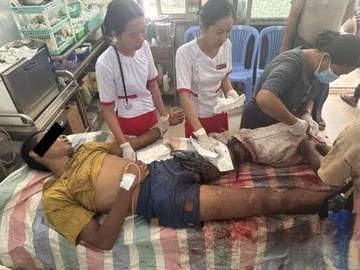 An innocent civlian injured in an improvised explosive device explosion in Shwegyin Township of Bago Region.